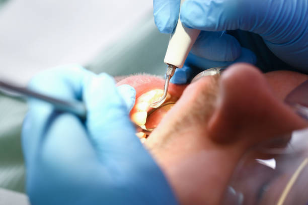 Best Emergency Dental Care for Broken or Chipped Teeth in Mount Healthy Heights, OH