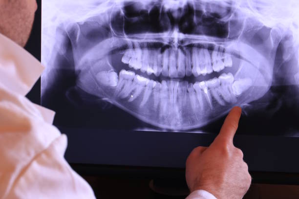 Best Emergency Treatment for Dental Infections or Abscesses in Mount Healthy Heights, OH